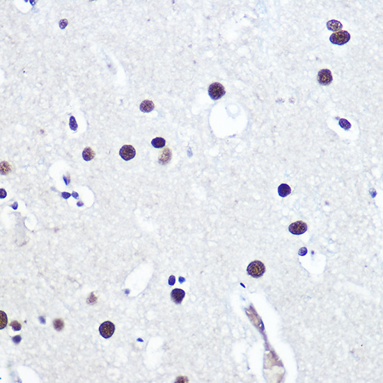 Immunohistochemistry of paraffin-embedded human brain using 53BP1 Polyclonal Antibody atdilution of 1:100 (40x lens).Perform high pressure antigen retrieval with 10 mM citrate buffer pH 6.0 before commencing with IHC staining protocol.