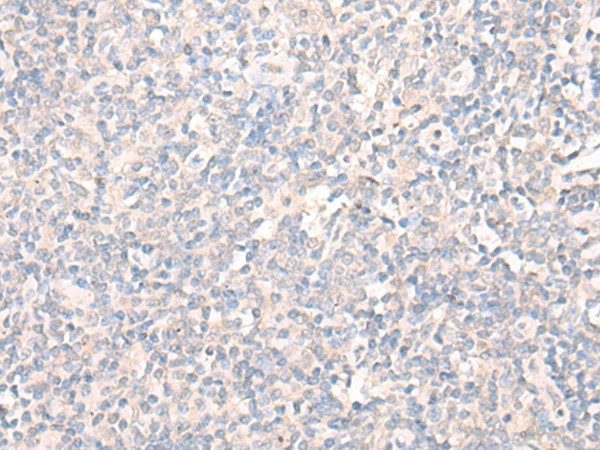 Immunohistochemistry of paraffin-embedded Human tonsil tissue  using LILRA2 Polyclonal Antibody at dilution of 1:40(?200)