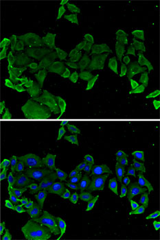 Immunofluorescence analysis of U2OS cells using COMP Polyclonal Antibody