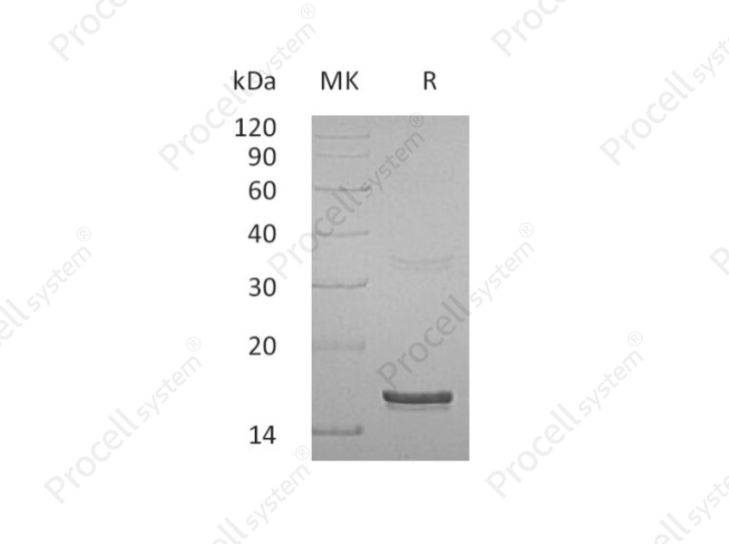 Interferon &gamma;/IFN-&gamma;/IFNG, Human, Recombinant