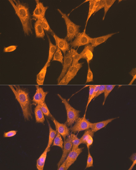 Immunofluorescence analysis of NIH/3T3 cells using PFKL Polyclonal Antibody at dilution of 1:100. Blue: DAPI for nuclear staining.