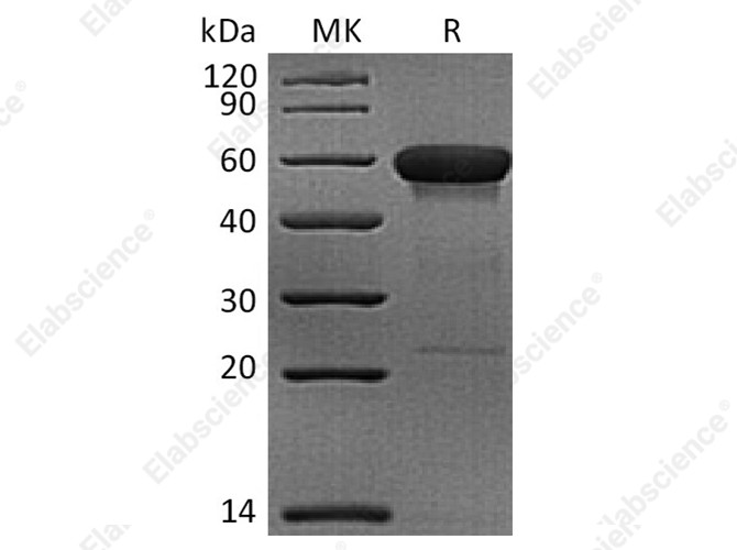 Recombinant Rhesus macaque CD160 Protein (Fc Tag) - 1