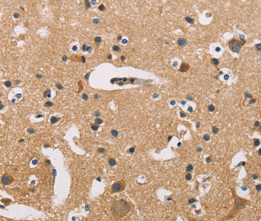 Immunohistochemistry of paraffin-embedded Human brain tissue using ATP2C1 Polyclonal Antibody at dilution 1:50