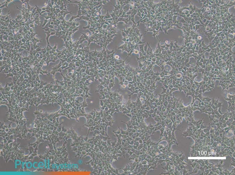 NCCITNCCIT - 2