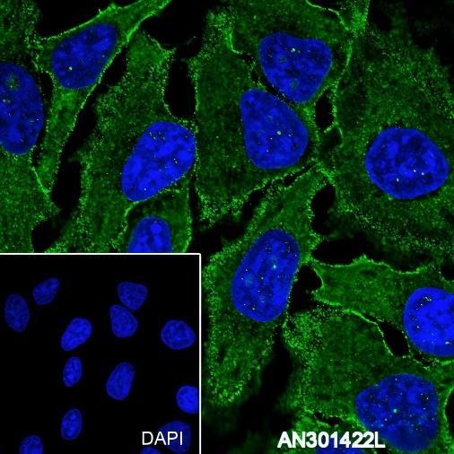 Recombinant TSHB Monoclonal Antibody - 3