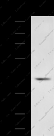 SERPINB5 Polyclonal Antibody - 1