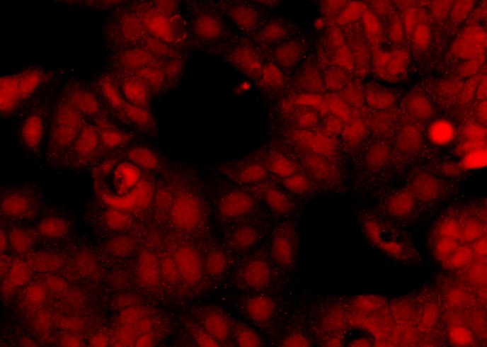 Recombinant OTUB2 Monoclonal Antibody-searchlist-1