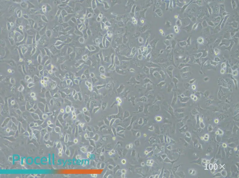 IGROV-1 Cell Complete Medium - 1