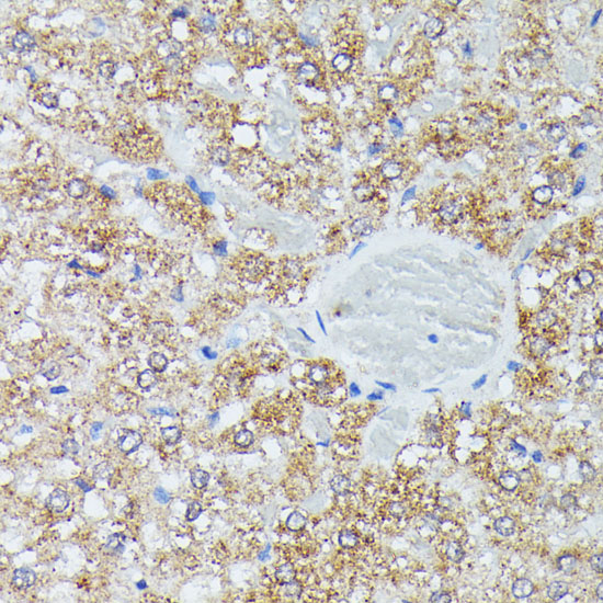 Immunohistochemistry of paraffin-embedded Rat liver using IVD Polyclonal Antibody at dilution of  1:100 (40x lens).