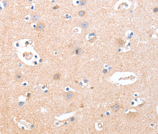 Immunohistochemistry of paraffin-embedded Human brain  using B3GAT1 Polyclonal Antibody at dilution of 1:40