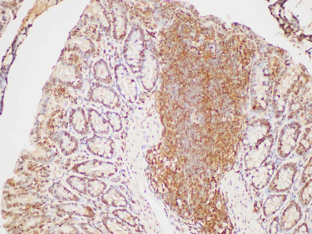 AF/LE Purified Anti-Mouse IL-17A Antibody[TC11-18H10.1]-产品推荐-1