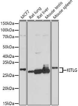 Western blot analysis of extracts of various cell lines using KITLG Polyclonal Antibody at 1:1000 dilution.