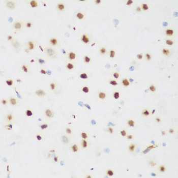 Immunohistochemistry of paraffin-embedded Mouse brain using CSRNP1 Polyclonal Antibody at dilution of  1:200 (40x lens).