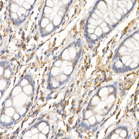 Immunohistochemistry of paraffin-embedded human colon using C19orf10 Polyclonal Antibody at dilution of 1:450 (40x lens).Perform high pressure antigen retrieval with 10 mM citrate buffer pH 6.0 before commencing with IHC staining protocol.