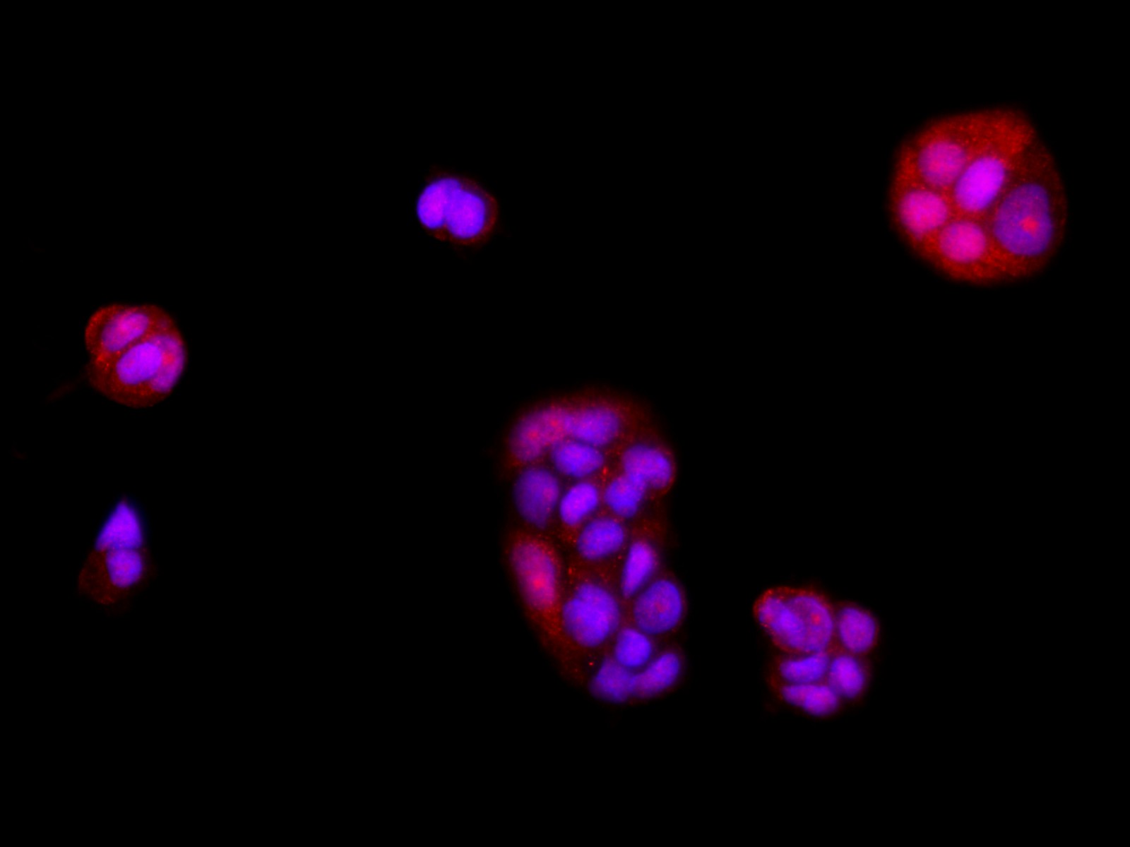 Immunofluorescence analysis of McF7 cells  using BRCA1 Polyclonal Antibody at dilution of 1:100