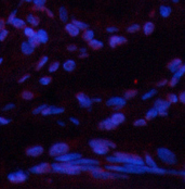 Immunofluorescence analysis of Human lung tissue using gamma Tubulin Monoclonal Antibody at dilution of 1:200.