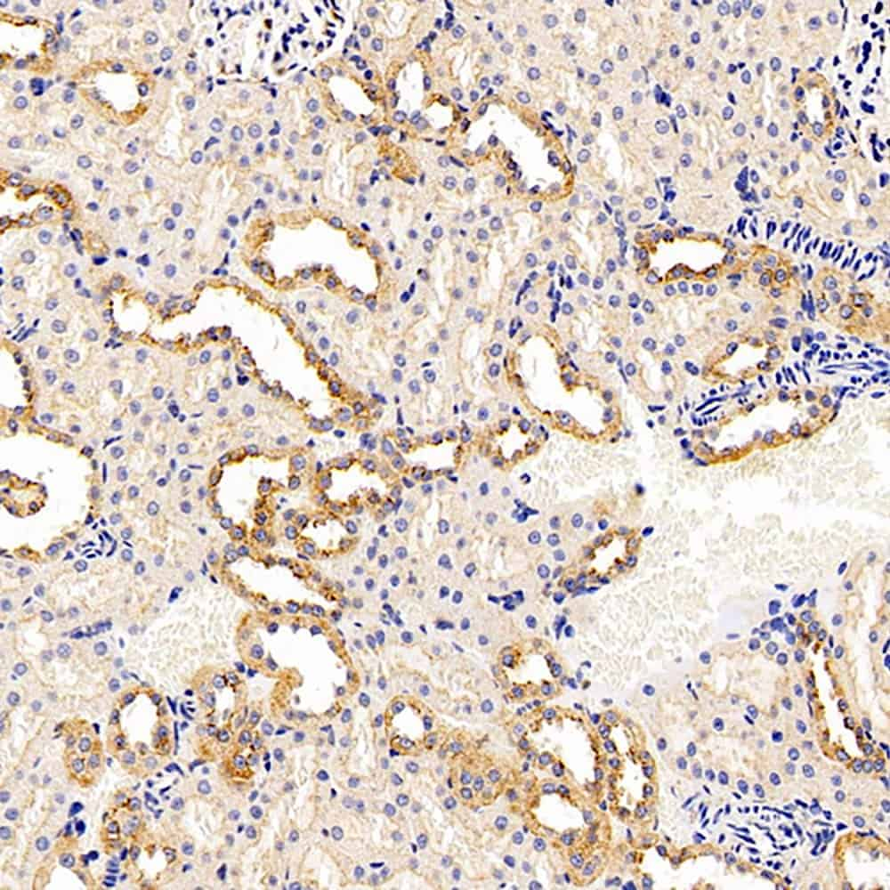 Immunohistochemistry analysis of paraffin-embedded rat kidney  using CK-7 Polyclonal Antibody at dilution of 1:200.