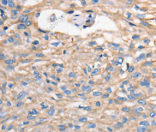 MVP Polyclonal Antibody - 3