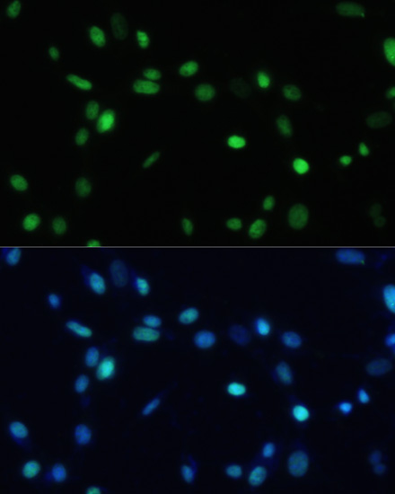 Immunofluorescence analysis of NIH-3T3 cells using SET Polyclonal Antibody at dilution of 1:100. Blue: DAPI for nuclear staining.