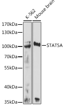 Western blot analysis of extracts of various cell lines using STAT5A Polyclonal Antibody at 1:500 dilution.