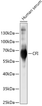 Western blot analysis of extracts of Human serum using CFI Polyclonal Antibody at 1:500 dilution.