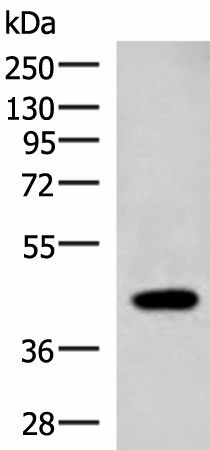 Western blot analysis of Raji cell lysate  using ADH1B Polyclonal Antibody at dilution of 1:1000