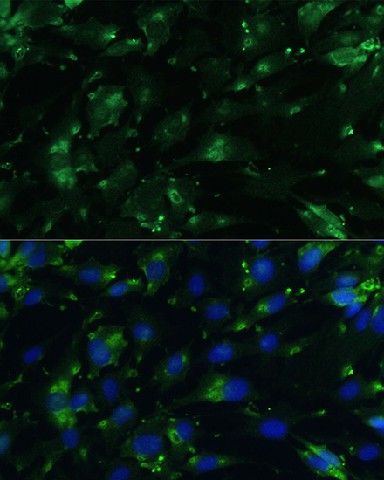 Immunofluorescence analysis of C6 cells using CGRP Polyclonal Antibody at dilution of 1:100. Blue: DAPI for nuclear staining.