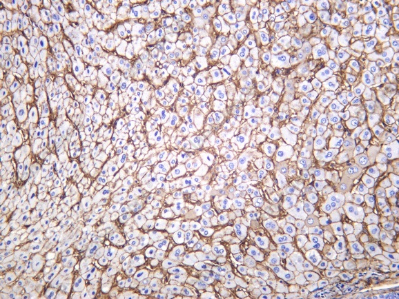 Recombinant Annexin VI Monoclonal Antibody - 1