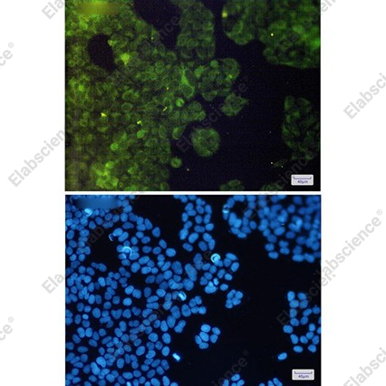 Recombinant AdSS 2 Monoclonal Antibody - 3
