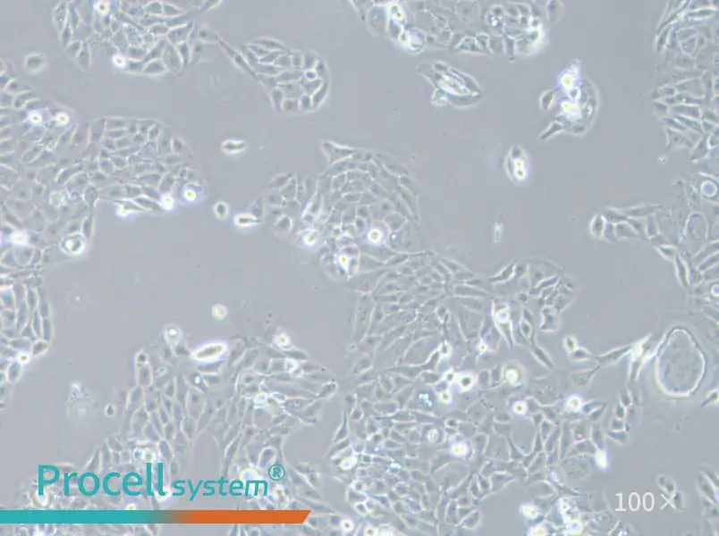 AMC-HN-8 Cell Complete Medium - 1