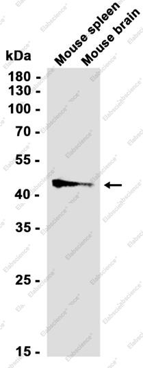 Recombinant SNX5 Monoclonal Antibody - 3