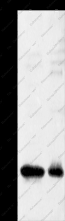 GNRHR Polyclonal Antibody - 1