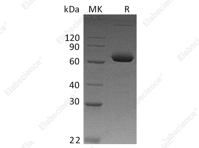 Recombinant Human IL-2RB/CD122 Protein (Fc Tag) - 1