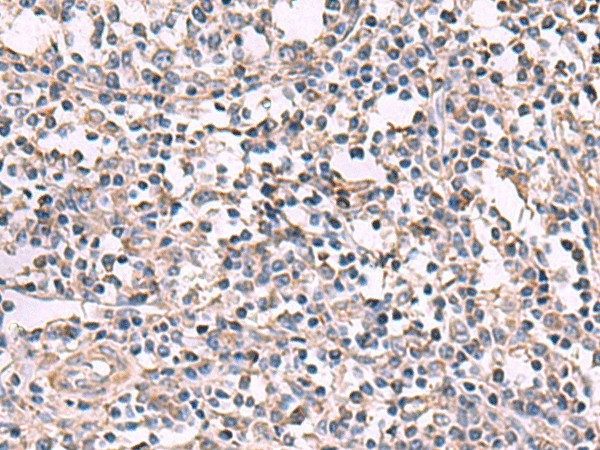 Immunohistochemistry of paraffin-embedded Human tonsil tissue  using KCNK18 Polyclonal Antibody at dilution of 1:80(?200)