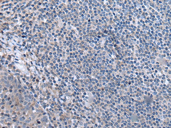 Immunohistochemistry of paraffin-embedded Human tonsil tissue  using CCK Polyclonal Antibody at dilution of 1:55. (Original magnific at ion: ?200) at dilution of 1:55(?200)