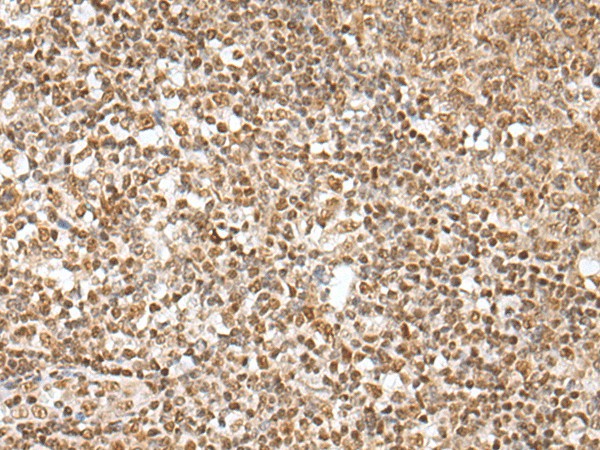 Immunohistochemistry of paraffin-embedded Human tonsil tissue  using ZNF354A Polyclonal Antibody at dilution of 1:40(?200)