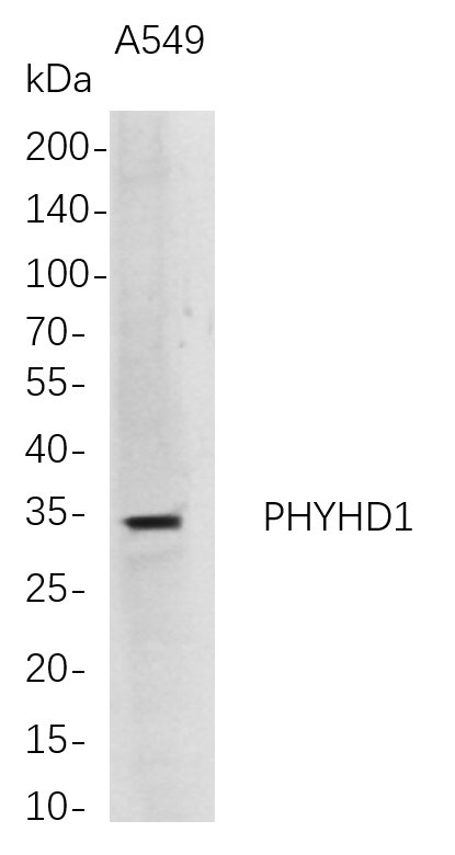 Recombinant PHYHD1 Monoclonal Antibody-searchlist-1