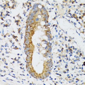 Immunohistochemistry of paraffin-embedded human vermiform appendix using SRP19 Polyclonal antibody at dilution of 1:100 (40x lens).Perform microwave antigen retrieval with 10 mM PBS buffer pH 7.2 before commencing with IHC staining protocol.
