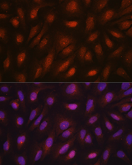 Immunofluorescence analysis of U2OS cells using CETN3 Polyclonal Antibody at dilution of  1:100. Blue: DAPI for nuclear staining.