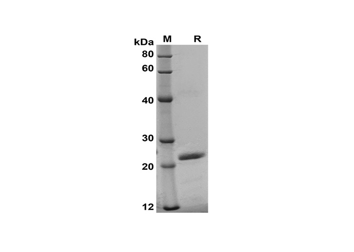 Recombinant Human PD-L1 Protein(His Tag)-产品推荐-1