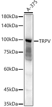 Western blot analysis of extracts of A-375 cells using TRPV Polyclonal Antibody at 1:1500 dilution.