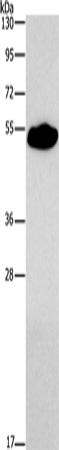 Western Blot analysis of Mouse heart tissue using SMAD9 Polyclonal Antibody at dilution of 1:290