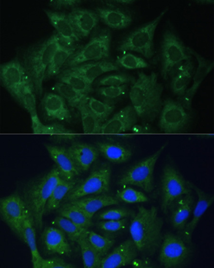 Immunofluorescence analysis of U-2 OS cells using IGF2BP2 Polyclonal Antibody at dilution of  1:100. Blue: DAPI for nuclear staining.