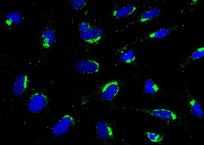 GOLM1/GP73 Monoclonal Antibody - small - 2