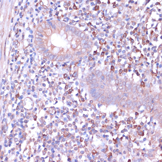 Immunohistochemistry of paraffin-embedded Human appendix using PRKACB Polyclonal Antibody at dilution of  1:100 (40x lens).