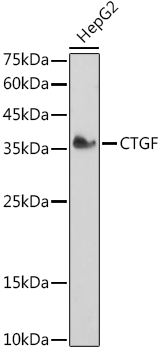 Western blot analysis of extracts of HepG2 cells using CTGF Polyclonal Antibody at 1:1000 dilution.