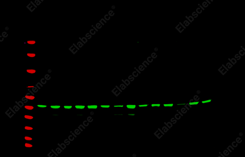 Recombinant α smooth muscle actin Monoclonal Antibody - 1