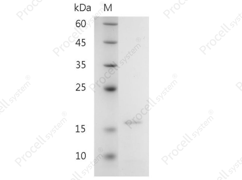 Galectin-10/Gal-10/LGALS10, Human, Recombinant