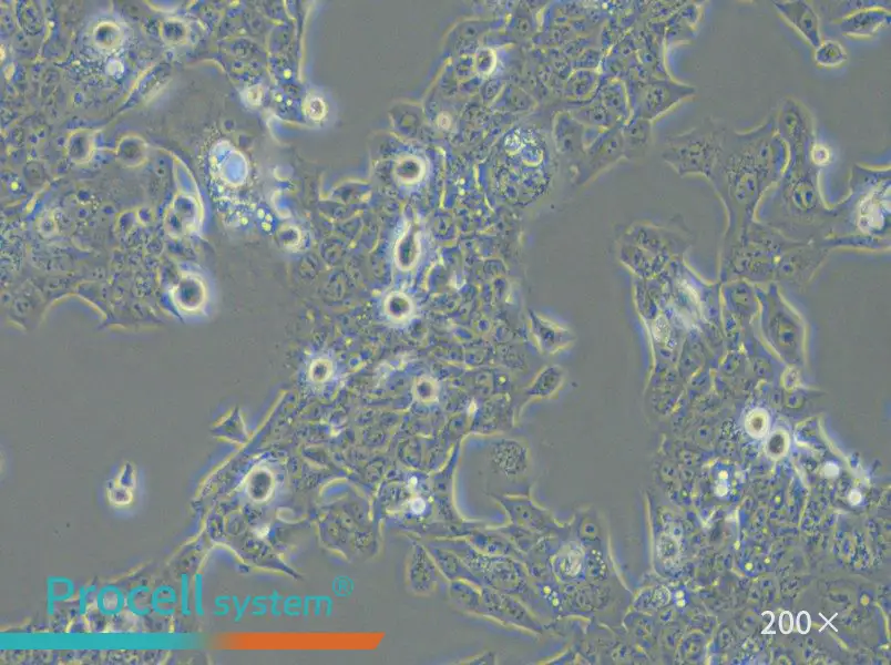 NCI-H441 Cell Complete Medium - 3