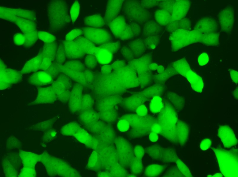 NCI-H446-LUC-EGFP Cell Complete Medium - 12